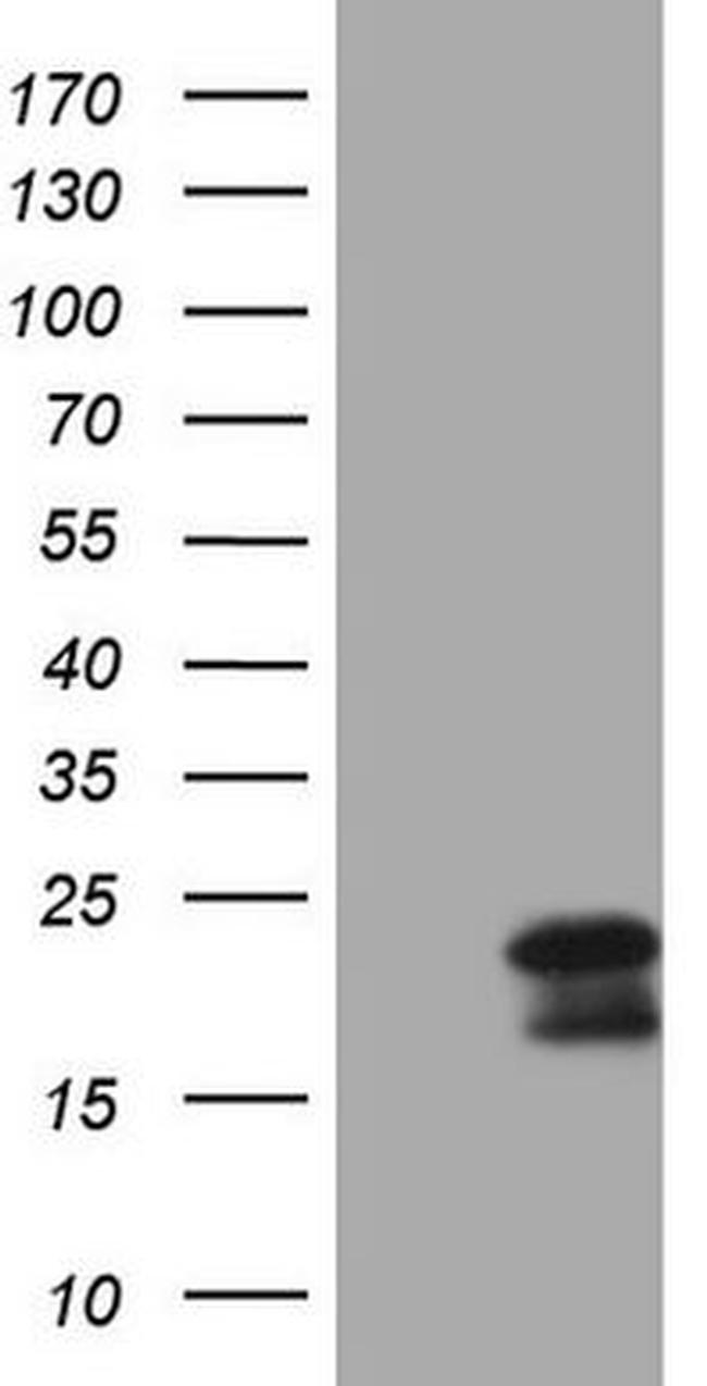 MCEE Antibody in Western Blot (WB)