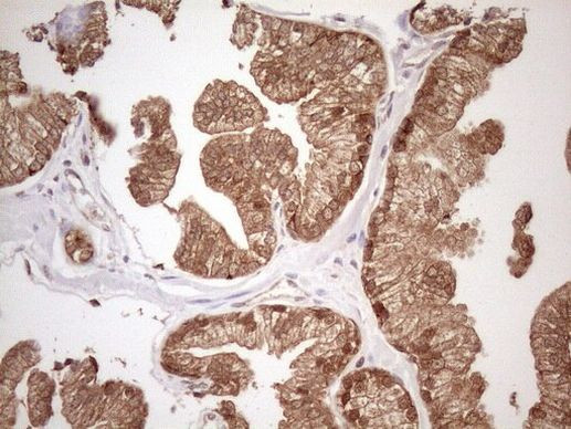 CHMP5 Antibody in Immunohistochemistry (Paraffin) (IHC (P))