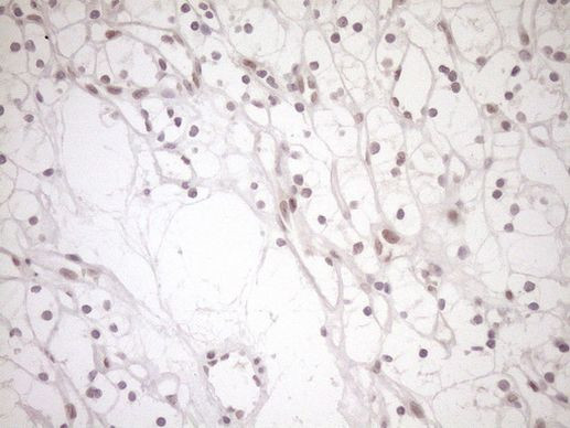 NAP1L3 Antibody in Immunohistochemistry (Paraffin) (IHC (P))