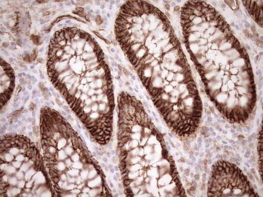 EPLIN Antibody in Immunohistochemistry (Paraffin) (IHC (P))