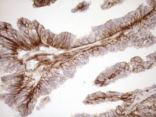 EPLIN Antibody in Immunohistochemistry (Paraffin) (IHC (P))