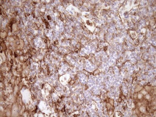 EPLIN Antibody in Immunohistochemistry (Paraffin) (IHC (P))