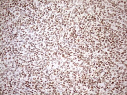 UTP11L Antibody in Immunohistochemistry (Paraffin) (IHC (P))