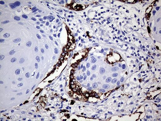 NAPSA Antibody in Immunohistochemistry (Paraffin) (IHC (P))