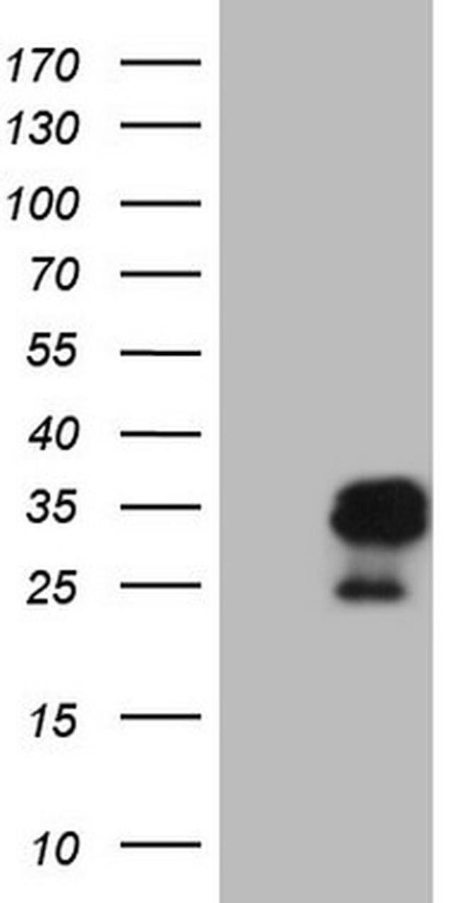 AMTN Antibody in Western Blot (WB)