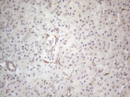 RBMS1 Antibody in Immunohistochemistry (Paraffin) (IHC (P))