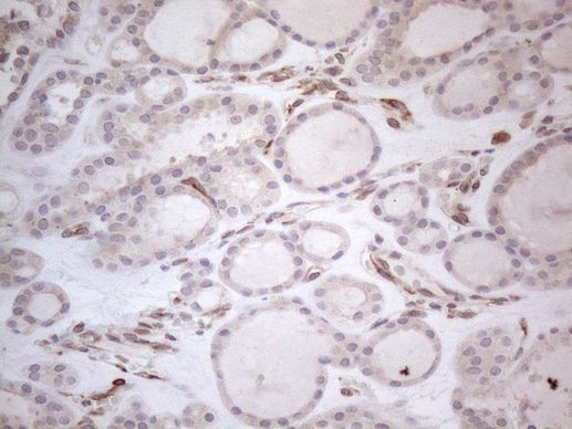 RBMS1 Antibody in Immunohistochemistry (Paraffin) (IHC (P))