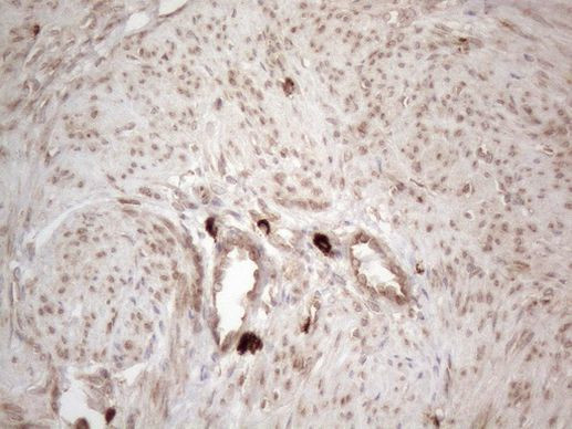 RBMS1 Antibody in Immunohistochemistry (Paraffin) (IHC (P))