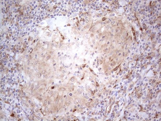 RBMS1 Antibody in Immunohistochemistry (Paraffin) (IHC (P))