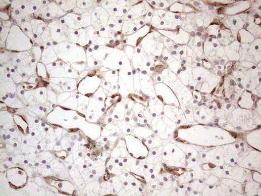 RBMS1 Antibody in Immunohistochemistry (Paraffin) (IHC (P))