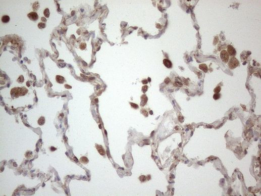 RBMS1 Antibody in Immunohistochemistry (Paraffin) (IHC (P))