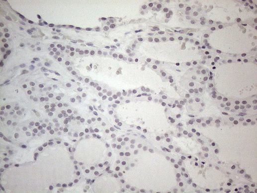 TDG Antibody in Immunohistochemistry (Paraffin) (IHC (P))