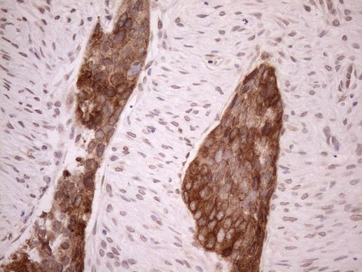 Aladin Antibody in Immunohistochemistry (Paraffin) (IHC (P))