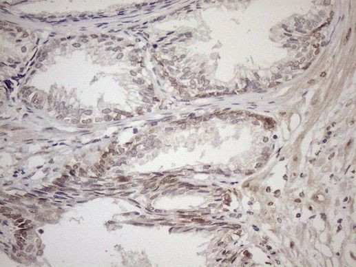 Aladin Antibody in Immunohistochemistry (Paraffin) (IHC (P))