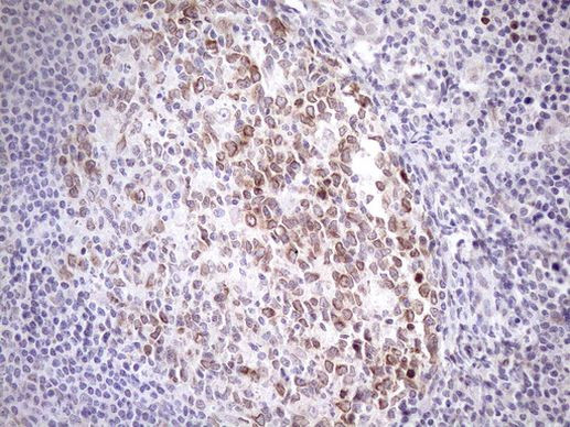 Aladin Antibody in Immunohistochemistry (Paraffin) (IHC (P))