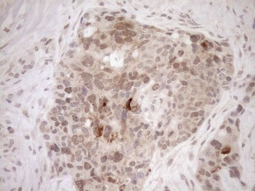 PARG Antibody in Immunohistochemistry (Paraffin) (IHC (P))