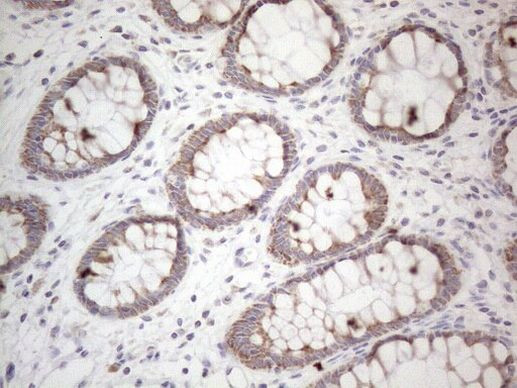 MRPL10 Antibody in Immunohistochemistry (Paraffin) (IHC (P))