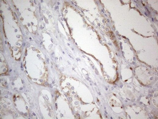 MRPL10 Antibody in Immunohistochemistry (Paraffin) (IHC (P))