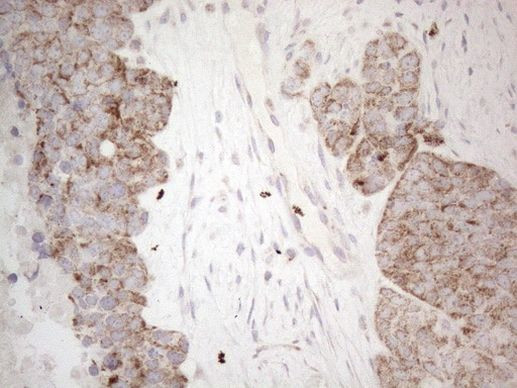 MRPL10 Antibody in Immunohistochemistry (Paraffin) (IHC (P))