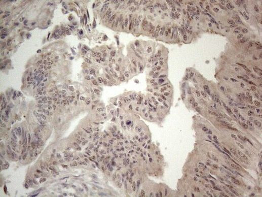 ZNF69 Antibody in Immunohistochemistry (Paraffin) (IHC (P))