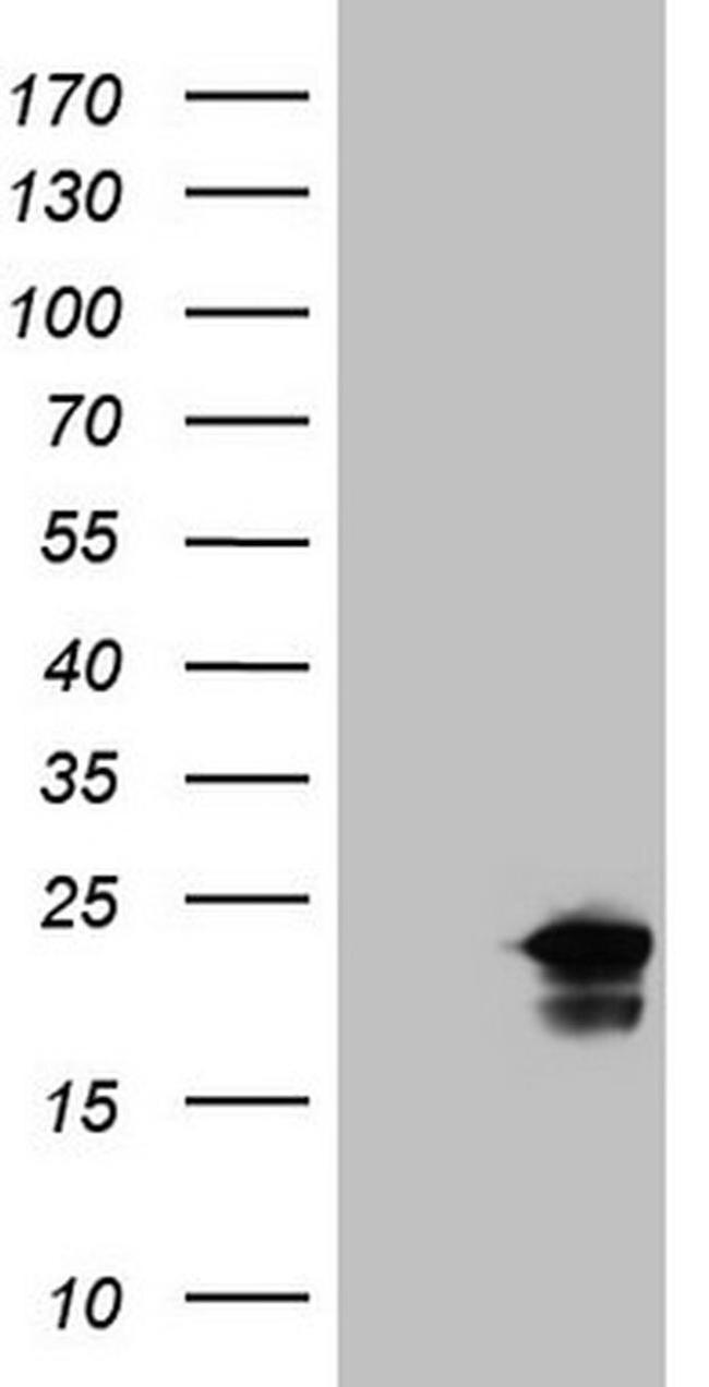 ZNF69 Antibody in Western Blot (WB)