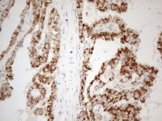 NAPSA Antibody in Immunohistochemistry (Paraffin) (IHC (P))