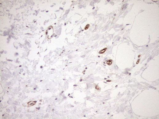 ASPDH Antibody in Immunohistochemistry (Paraffin) (IHC (P))