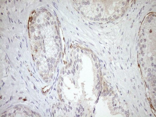 ASPDH Antibody in Immunohistochemistry (Paraffin) (IHC (P))