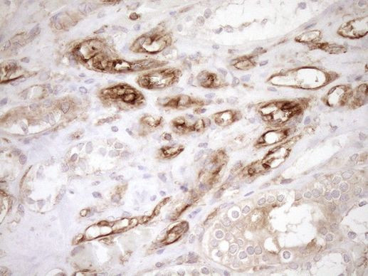 ASPDH Antibody in Immunohistochemistry (Paraffin) (IHC (P))