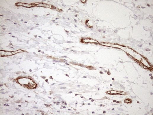 ASPDH Antibody in Immunohistochemistry (Paraffin) (IHC (P))