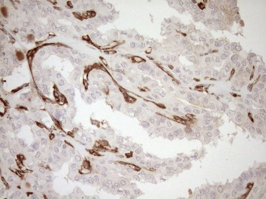 ASPDH Antibody in Immunohistochemistry (Paraffin) (IHC (P))