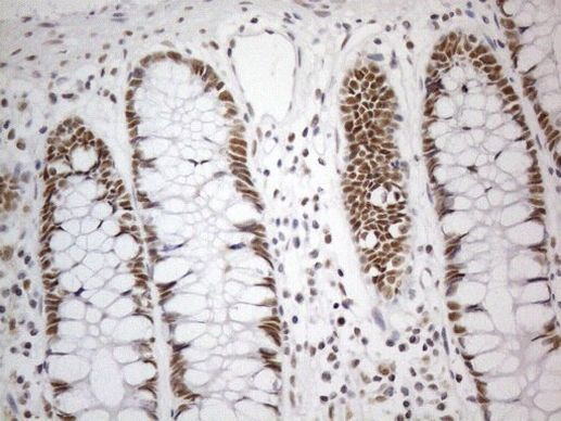 CWC27 Antibody in Immunohistochemistry (Paraffin) (IHC (P))