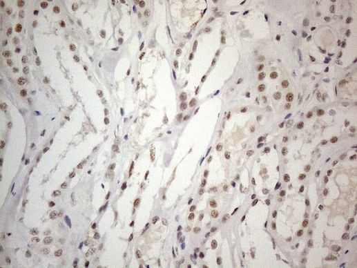 CWC27 Antibody in Immunohistochemistry (Paraffin) (IHC (P))