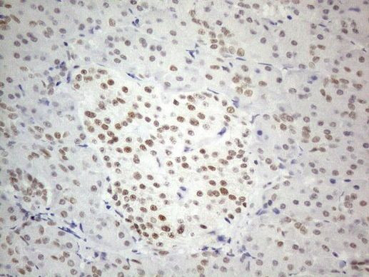 CWC27 Antibody in Immunohistochemistry (Paraffin) (IHC (P))