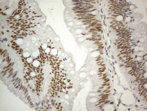 CWC27 Antibody in Immunohistochemistry (Paraffin) (IHC (P))