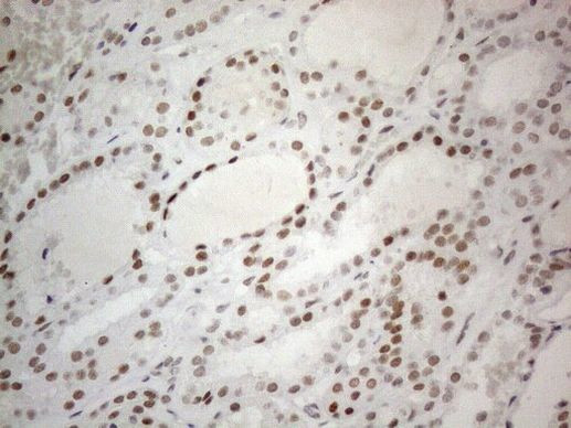 CWC27 Antibody in Immunohistochemistry (Paraffin) (IHC (P))