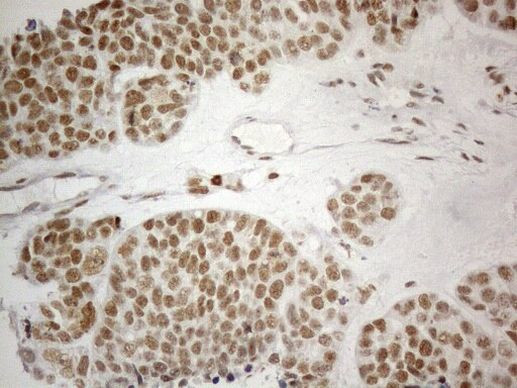 CWC27 Antibody in Immunohistochemistry (Paraffin) (IHC (P))