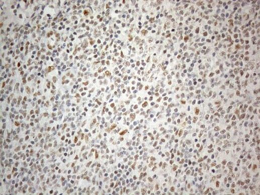 CWC27 Antibody in Immunohistochemistry (Paraffin) (IHC (P))