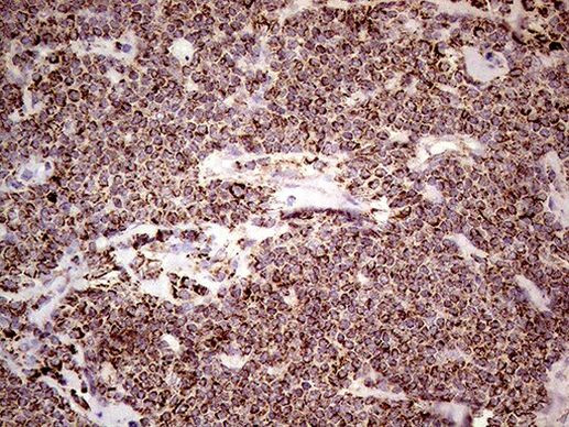 SHMT2 Antibody in Immunohistochemistry (Paraffin) (IHC (P))