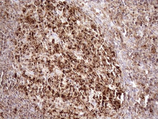 SHMT2 Antibody in Immunohistochemistry (Paraffin) (IHC (P))