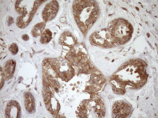 HOXC10 Antibody in Immunohistochemistry (Paraffin) (IHC (P))