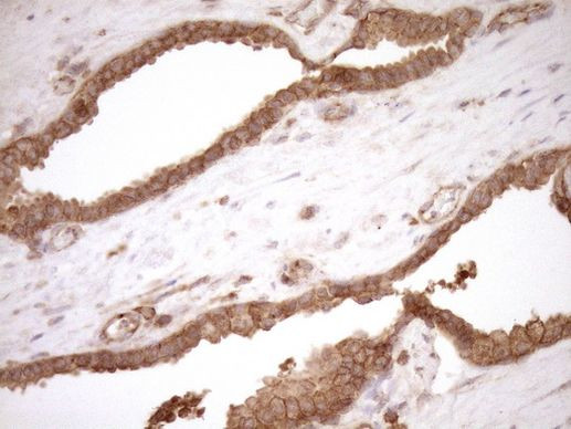 HOXC10 Antibody in Immunohistochemistry (Paraffin) (IHC (P))