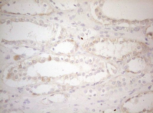 MAD4 Antibody in Immunohistochemistry (Paraffin) (IHC (P))