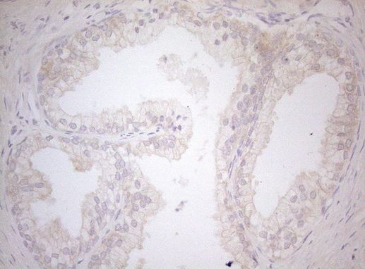 MAD4 Antibody in Immunohistochemistry (Paraffin) (IHC (P))