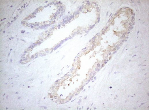 MAD4 Antibody in Immunohistochemistry (Paraffin) (IHC (P))