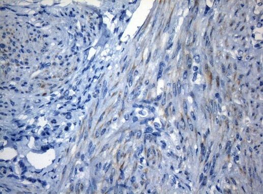 ZNF394 Antibody in Immunohistochemistry (Paraffin) (IHC (P))