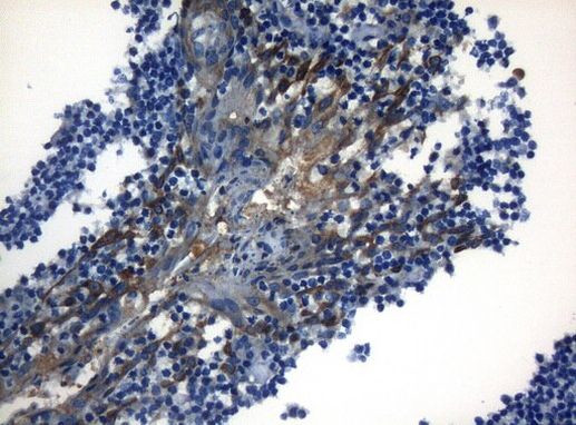 ZNF394 Antibody in Immunohistochemistry (Paraffin) (IHC (P))