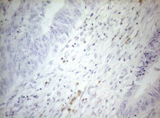 ZNF394 Antibody in Immunohistochemistry (Paraffin) (IHC (P))