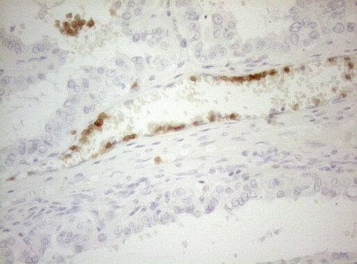 ZNF394 Antibody in Immunohistochemistry (Paraffin) (IHC (P))