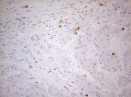 ZNF394 Antibody in Immunohistochemistry (Paraffin) (IHC (P))